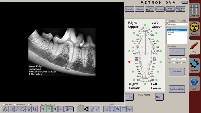 apixia Digital Dental Radiology System - Image 9