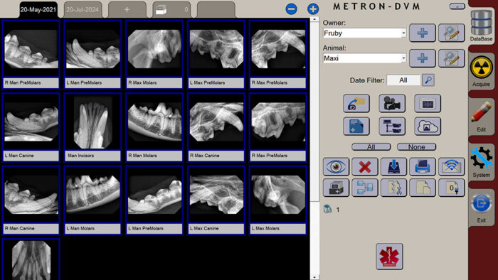 apixia Digital Dental Radiology System - Image 10