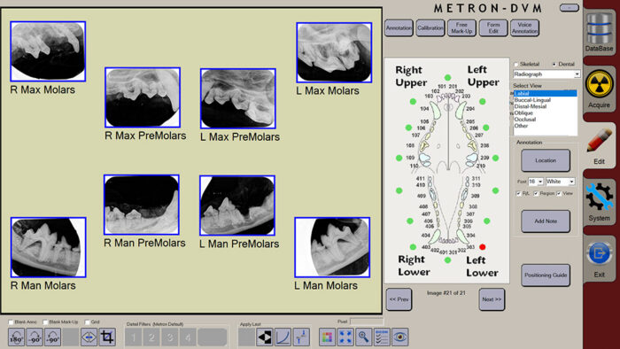 apixia Digital Dental Radiology System - Image 11